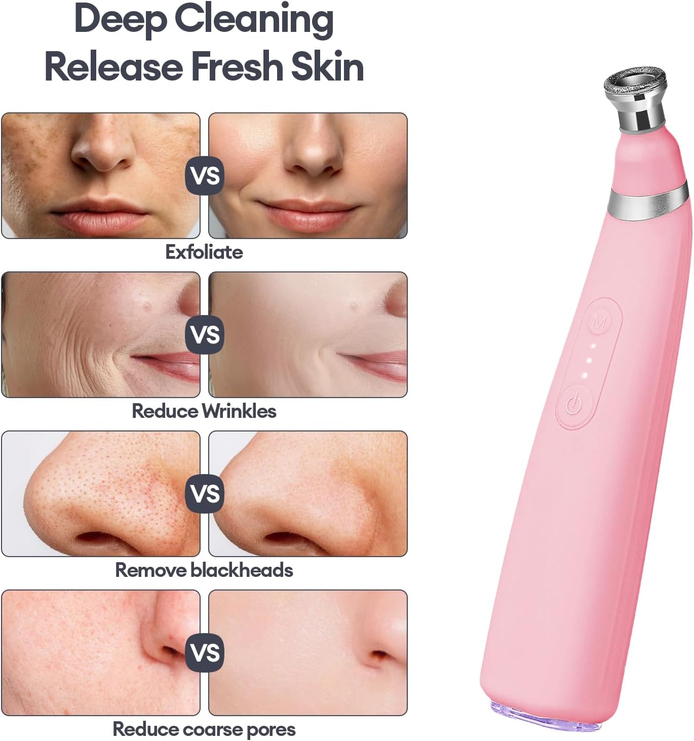 DiamondSkin™ - Blackhead & Exfoliation Machine
